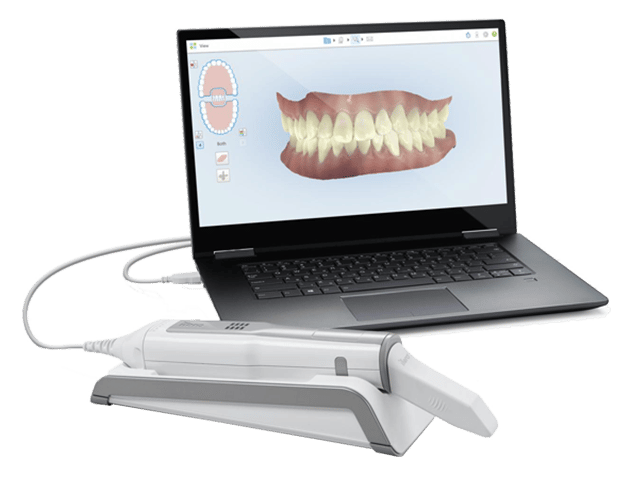 Itero element intraoral scanner