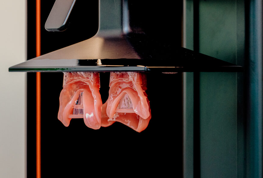 3D Printed Dentures