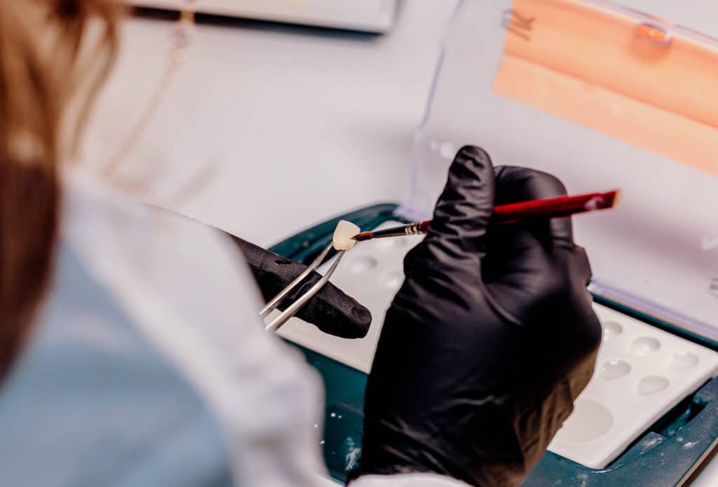 What to know about Zirconia crowns [from industry experts]