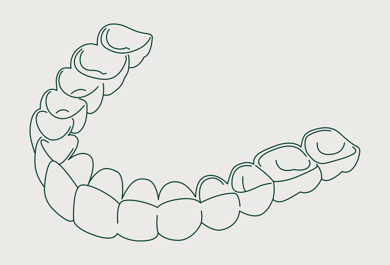 Aligners