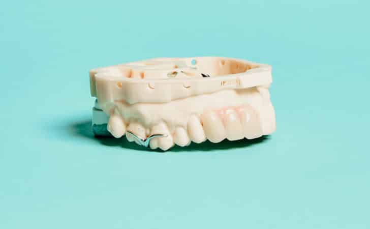 partial denture process from start to finish