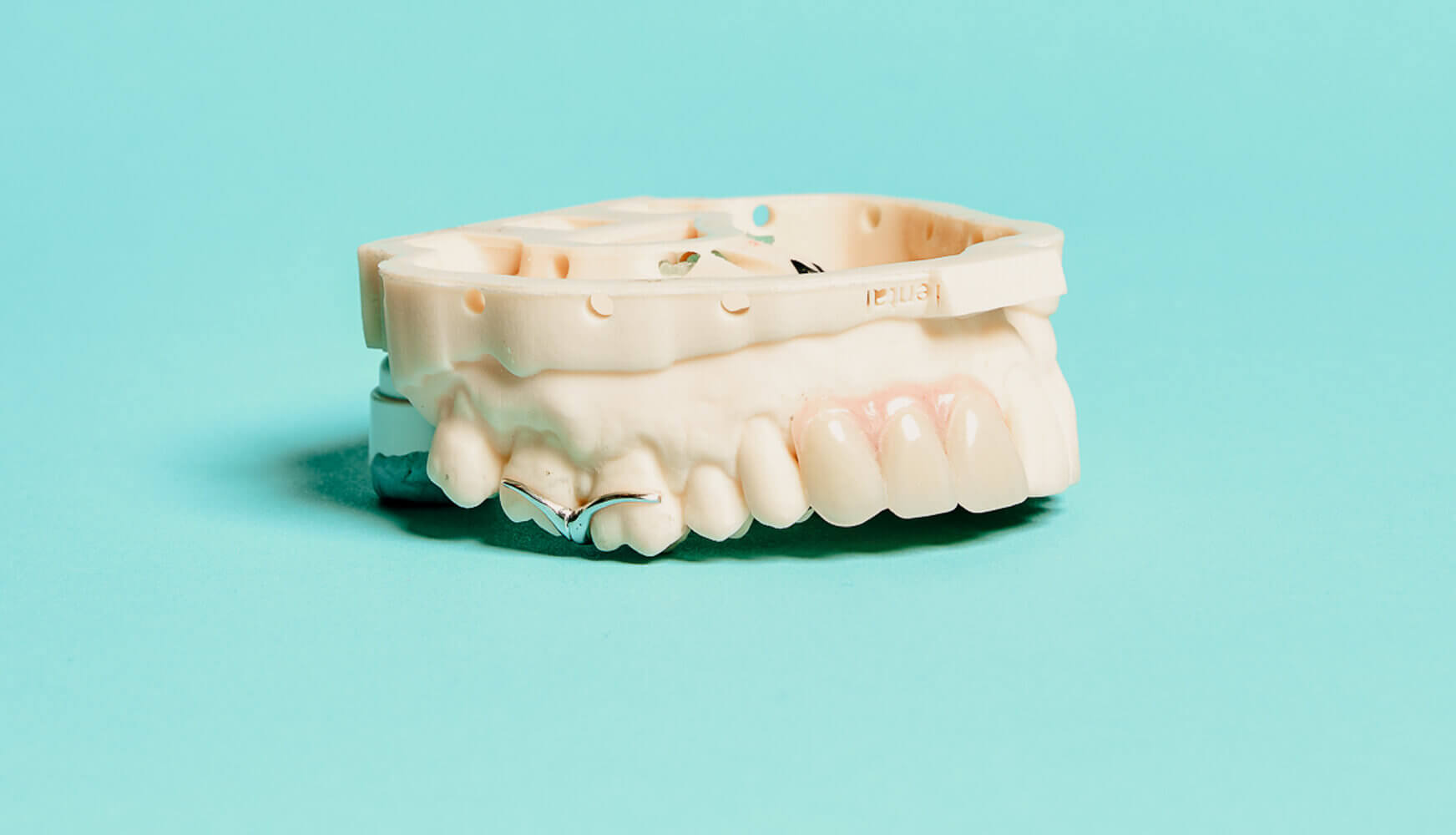 digital dentures access