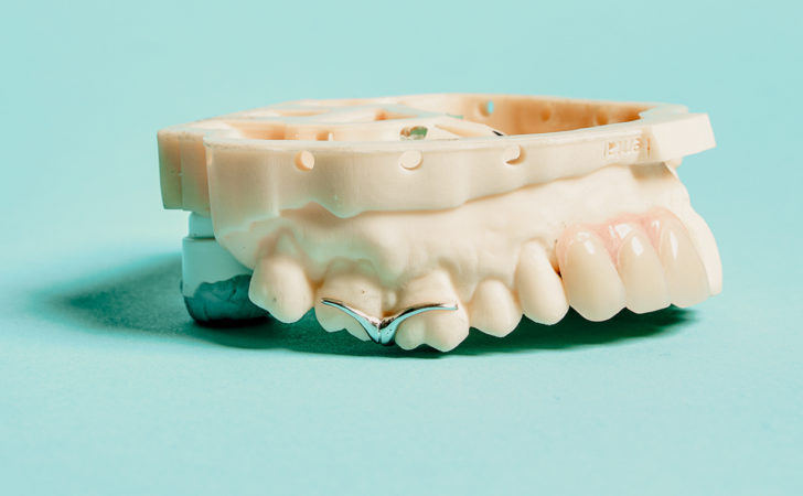 Digital Dentures