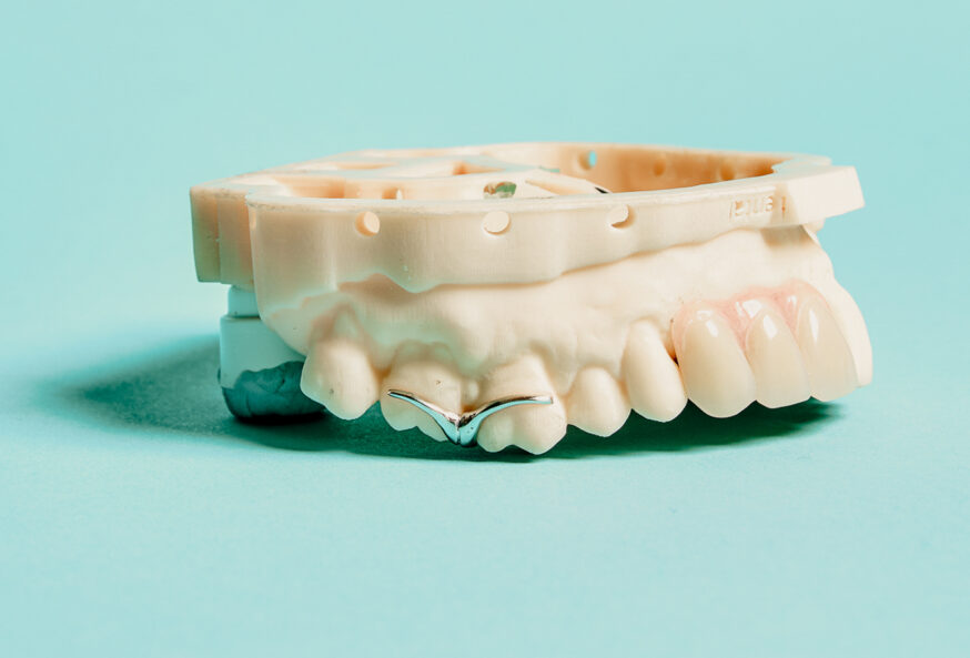 Digital Dentures
