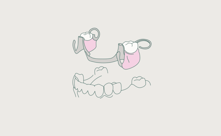 partial dentures