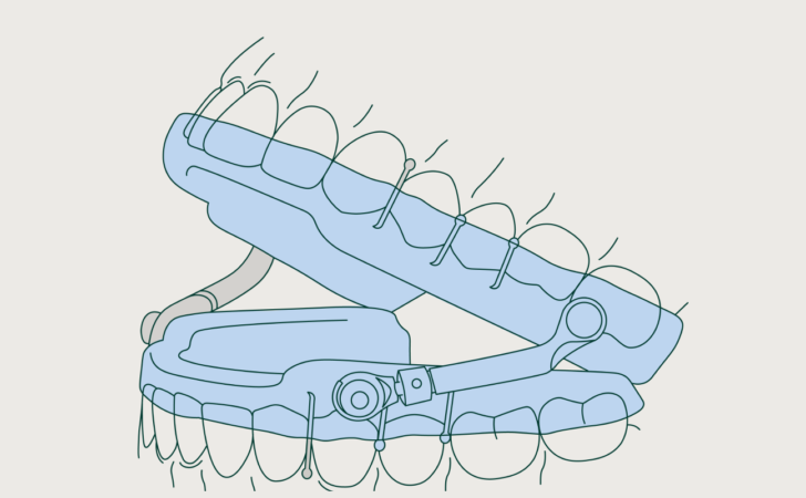 Sleep apnea devices with Dandy