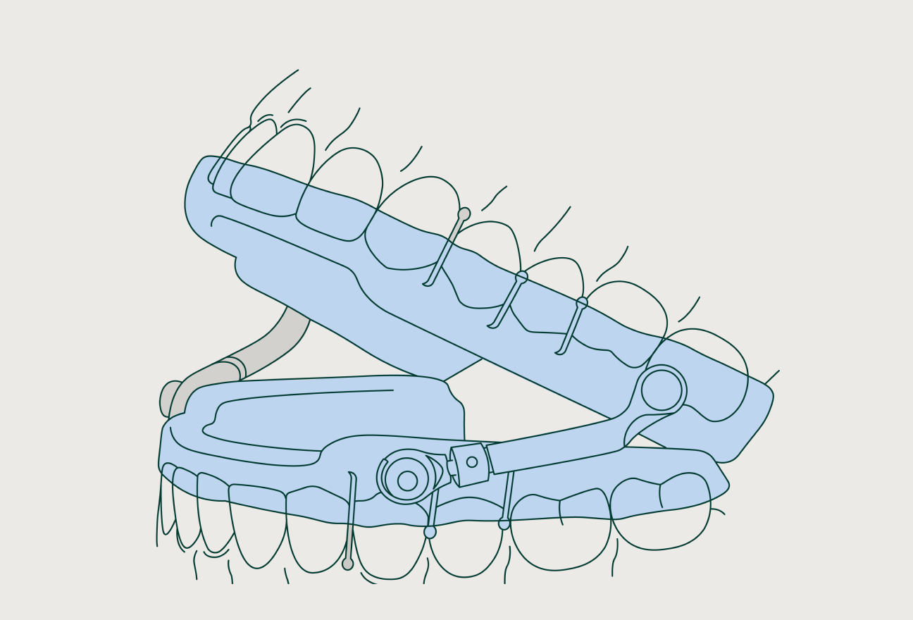 Sleep apnea devices with Dandy