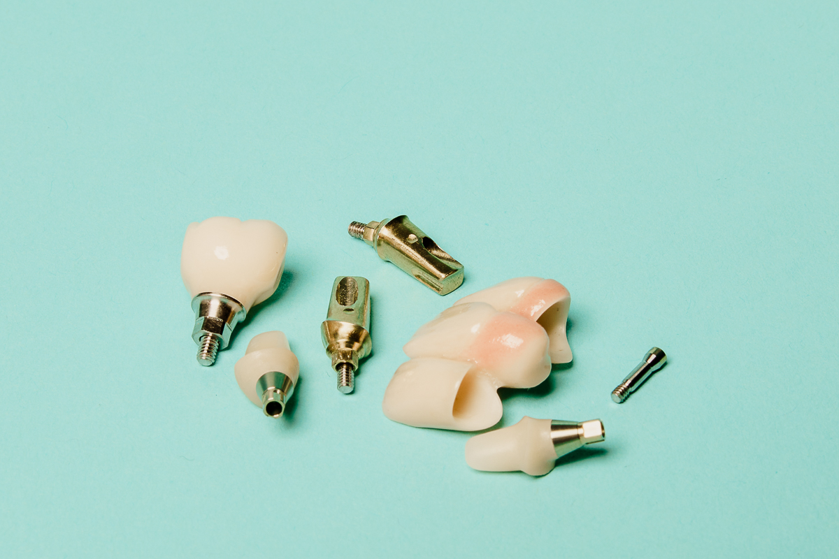dental lab implant restorations