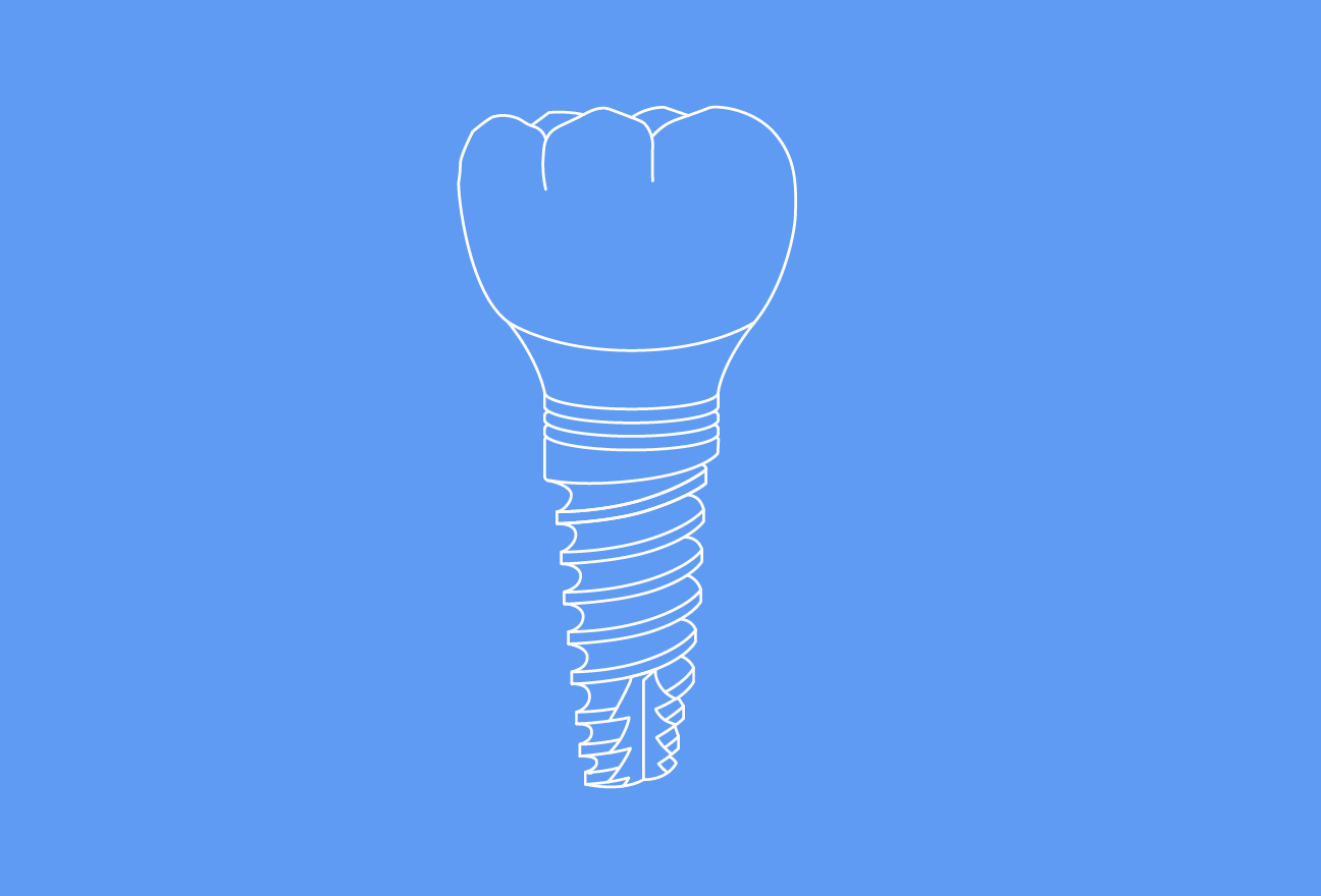 Implant Restorations