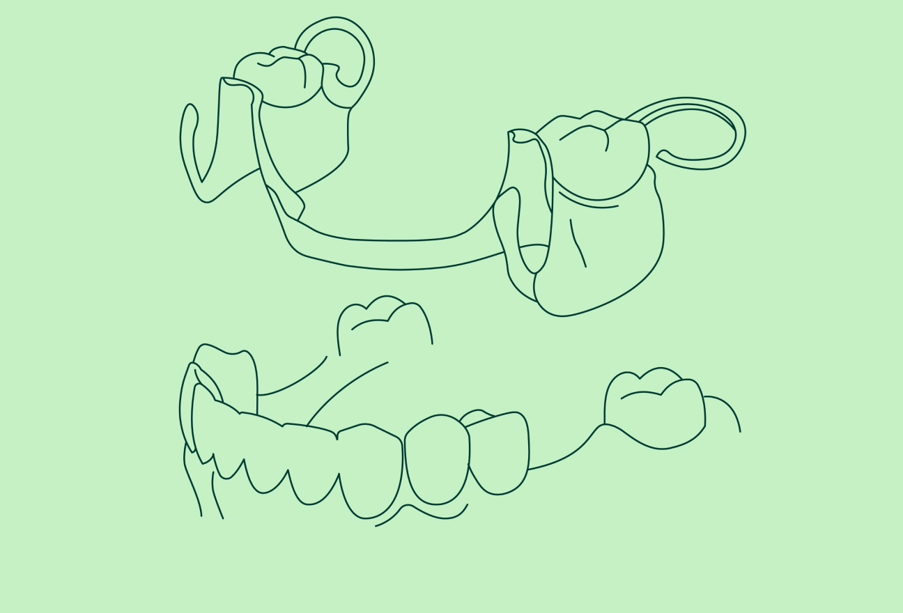 Partial Dentures