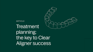 Clear aligners article header