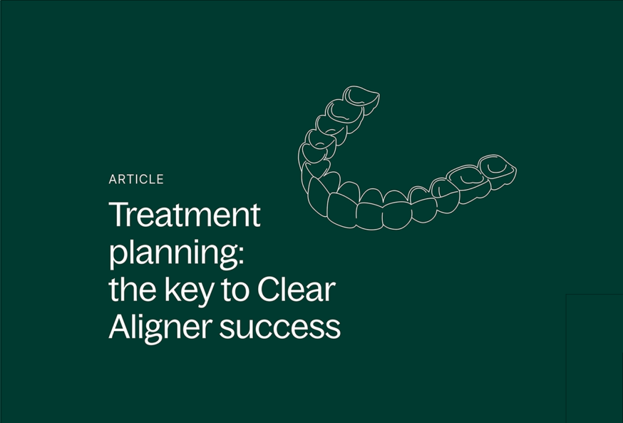 Clear aligners article header