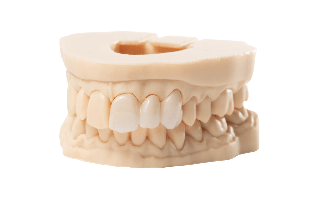 Dental impressions: Types and materials