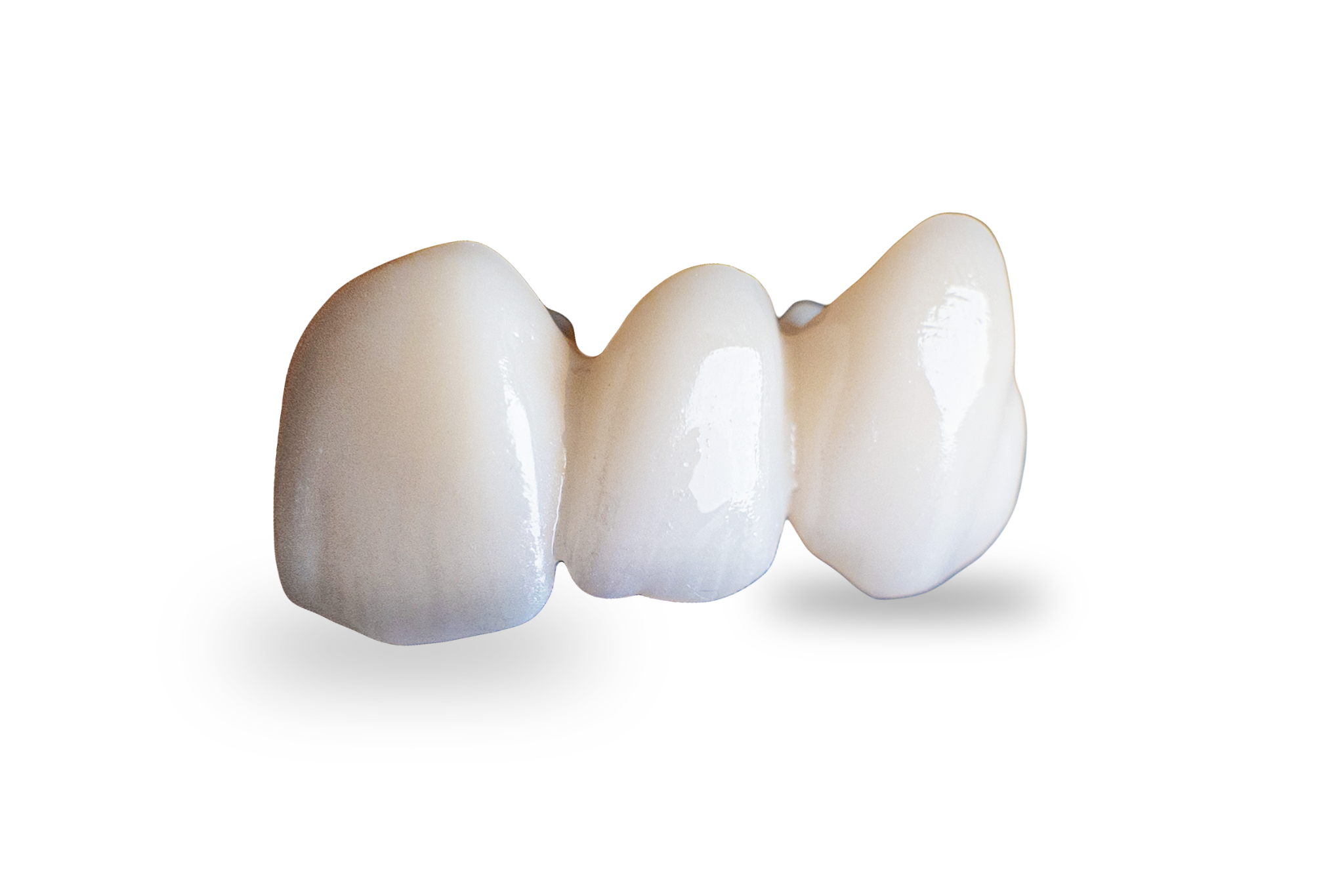 Aesthetic zirconia