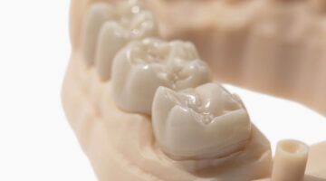 Monolithic Zirconia