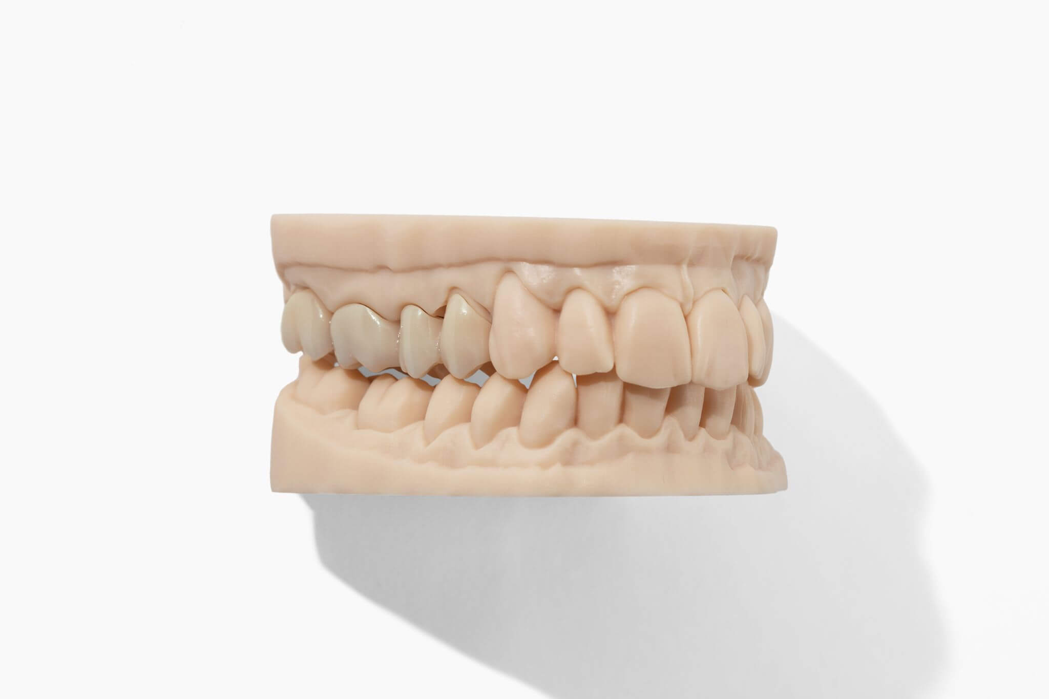 monolithic zirconia