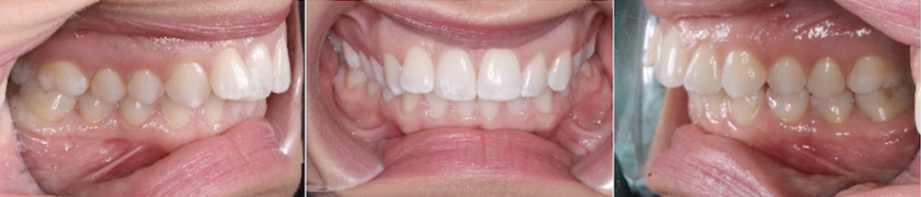 examples of dental photography