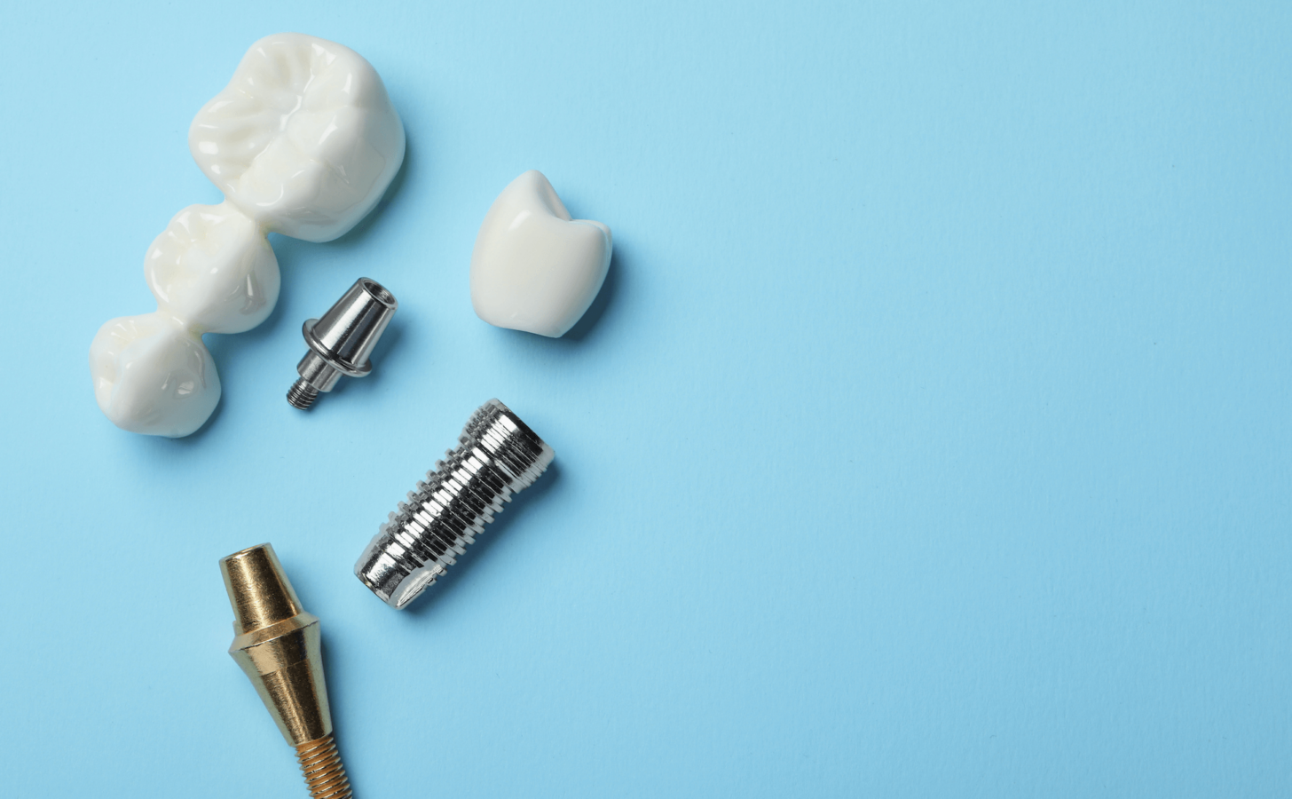 Screw retained vs cement retained implants Dandy
