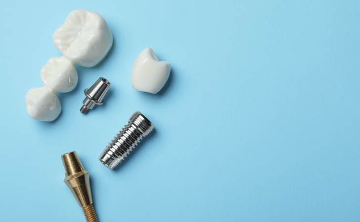 dental implant parts