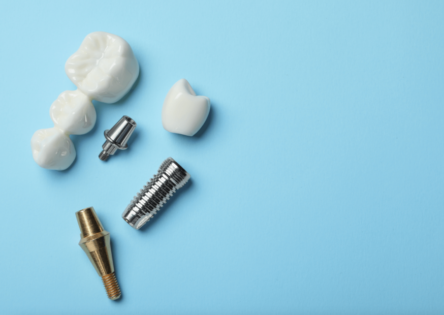 dental implant parts