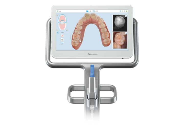 Which iTero scanner is best for you? - Dandy