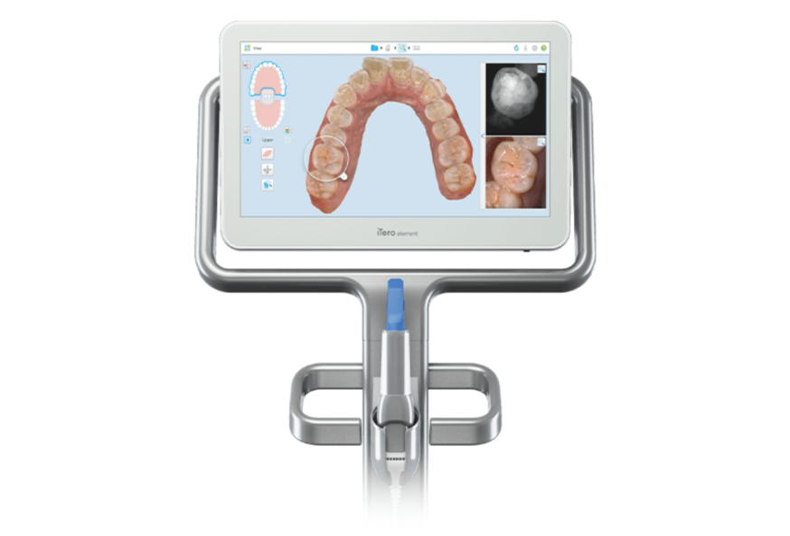 iTero Element 5D intraoral scanner