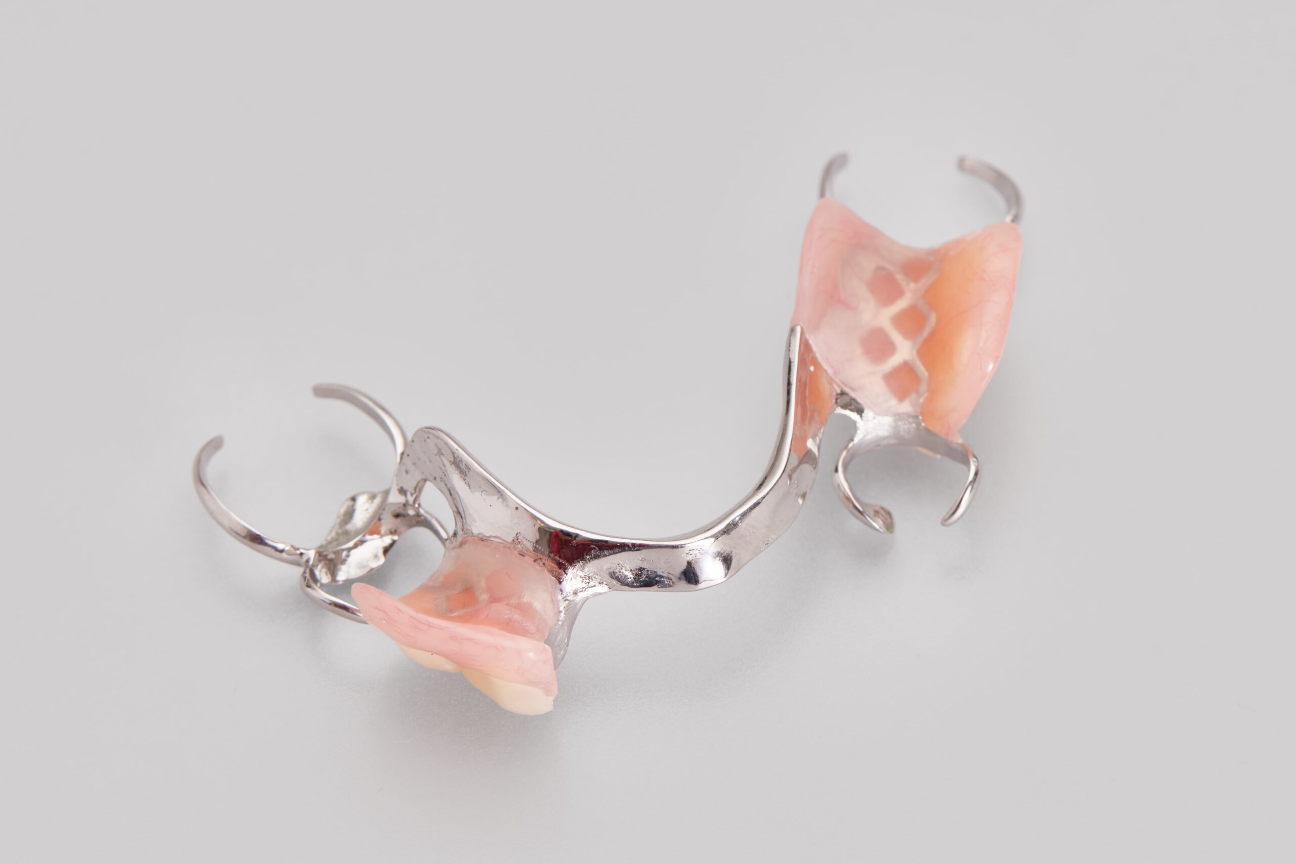 cast metal partial dentures