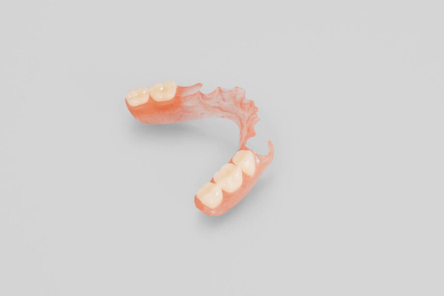 flex partial denture