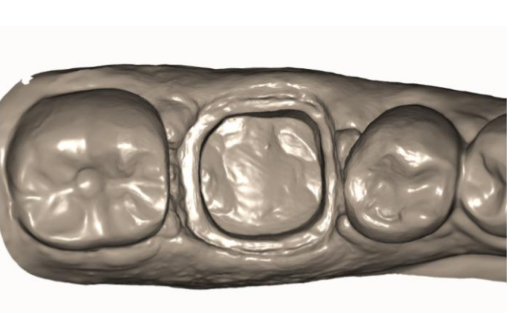 Scan of margin taken with a double cord technique