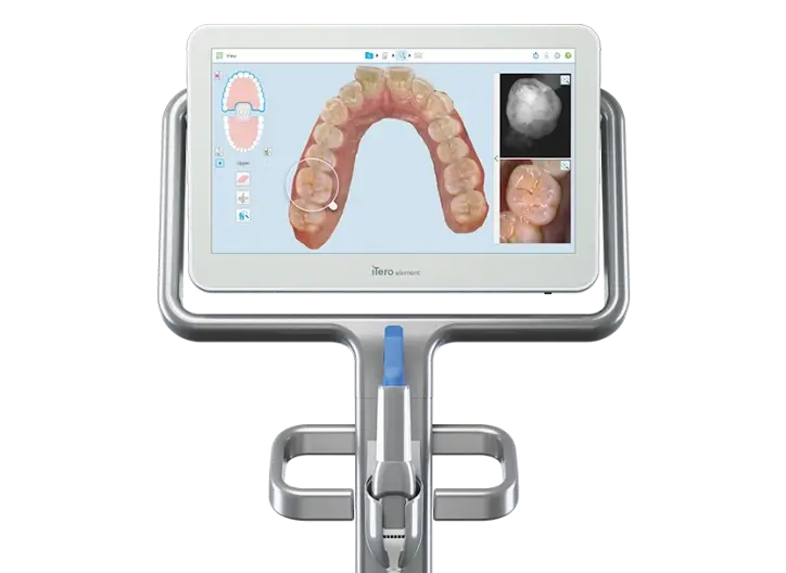 iTero Element 5D scanner