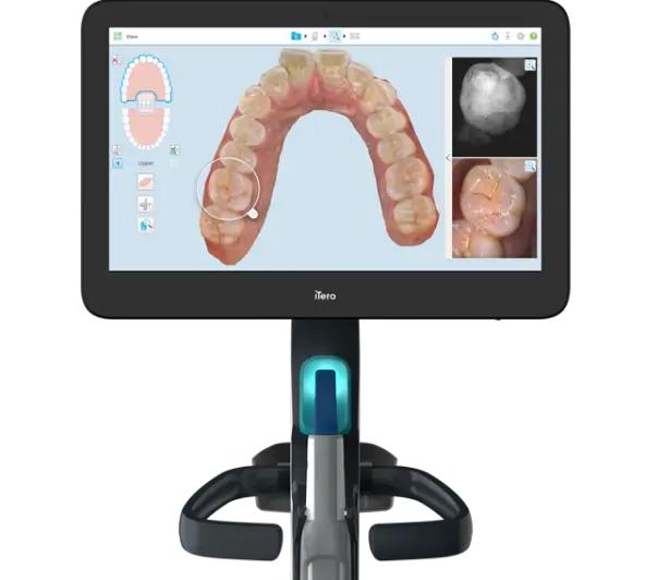 iTero 5D Plus scanner