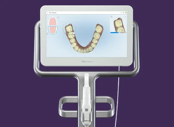 iTero Element 2 intraoral scanner