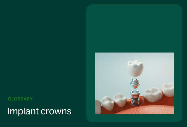 Dental glossary implant crowns