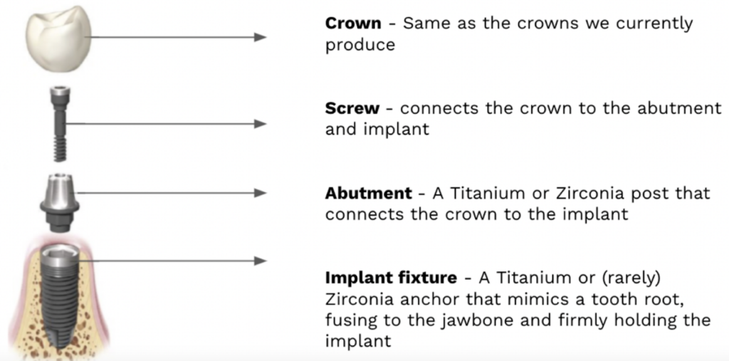 dental implant parts 