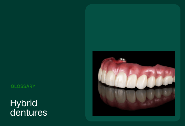 Glossary image for hybrid dentures