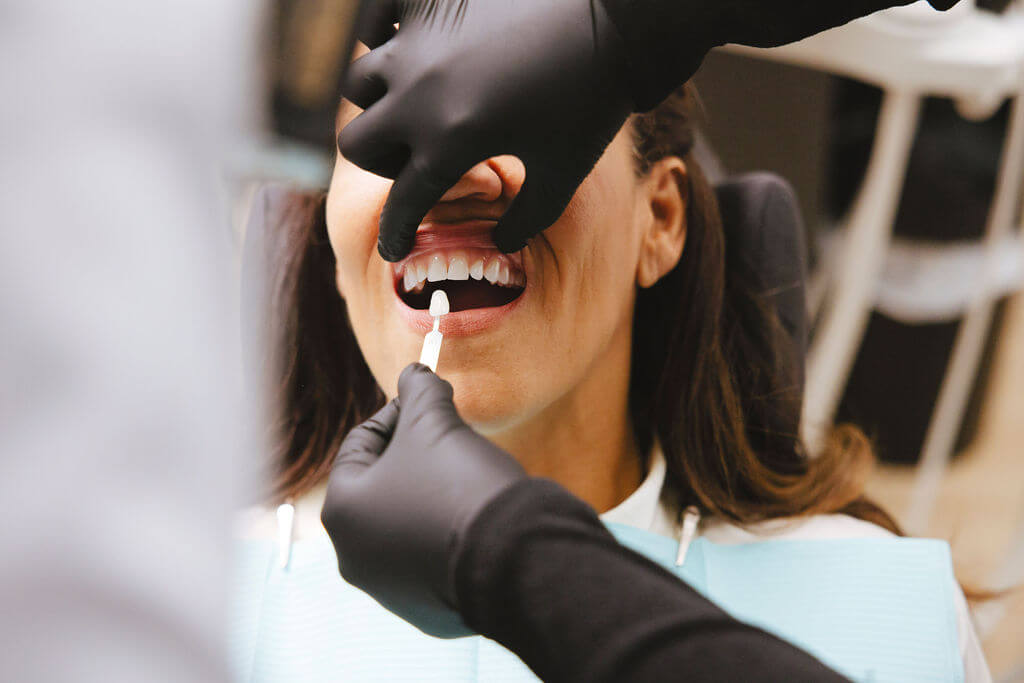 an example of a dental picture