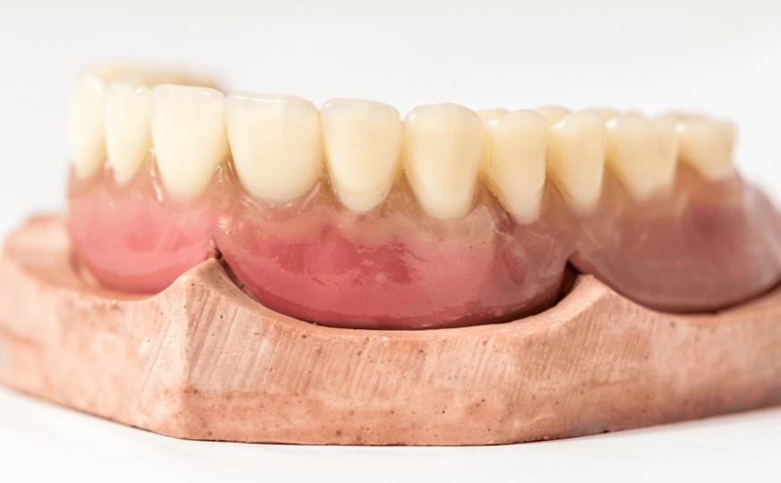 Immediate dentures image