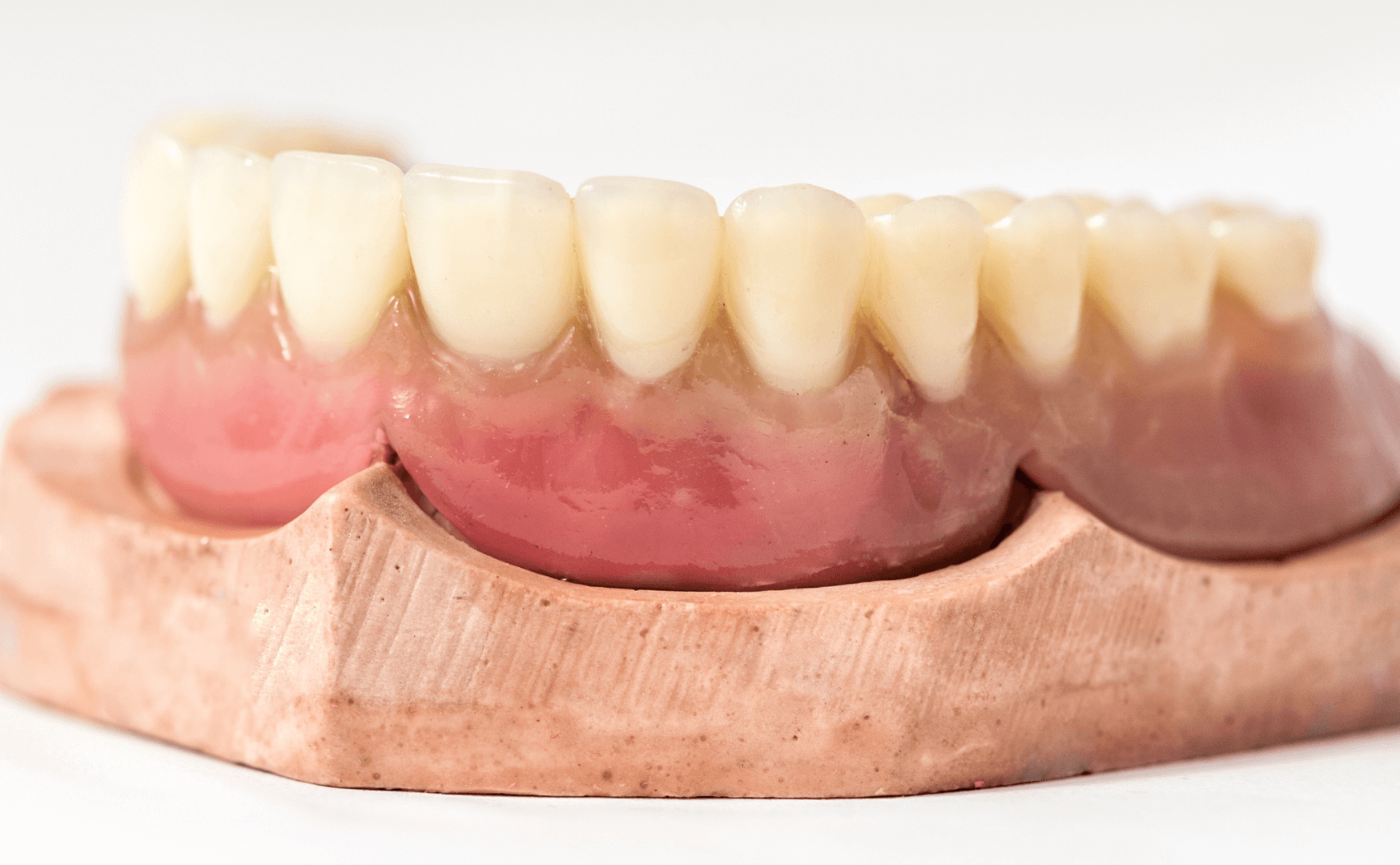 Immediate Dentures Pros and Cons, Timeline & More