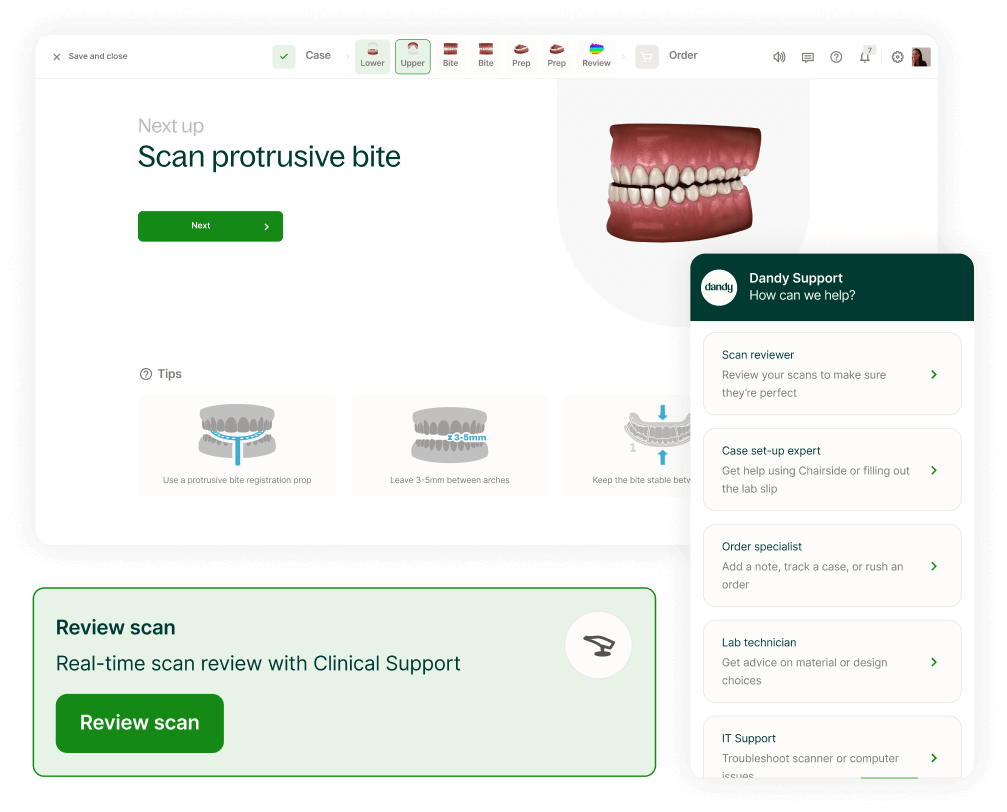 Intraoral scanning training for your team