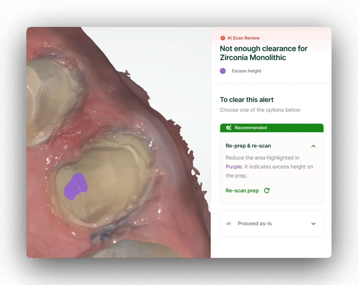 dandy occlusal clearance