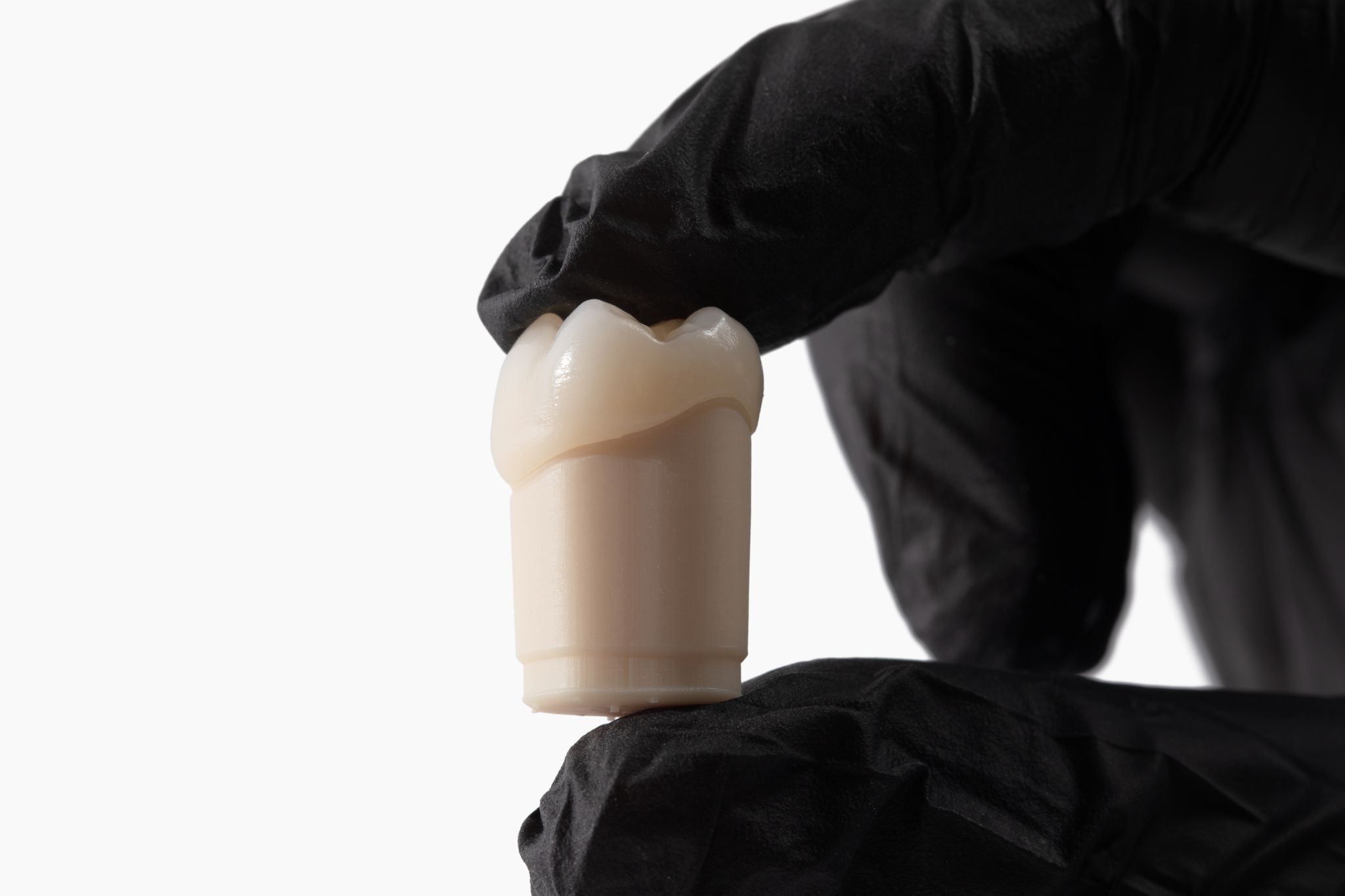 Dandy posterior crown