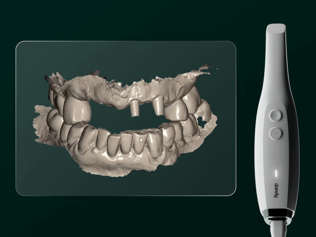 dandy vision scanner