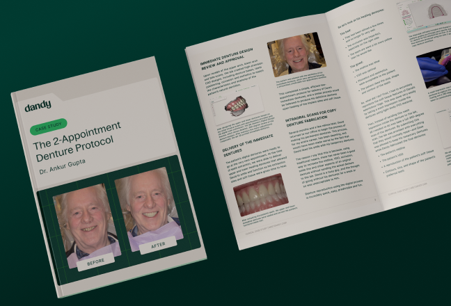 Case Study: Two Appointment Denture Protocol