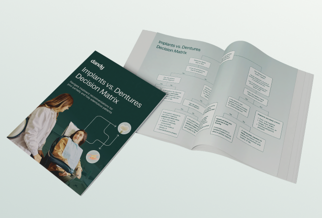 Implant vs Dentures Decision Matrix