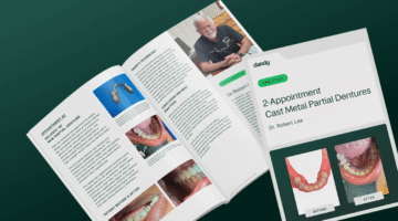 2-Appointment Acrylic Partial Dentures