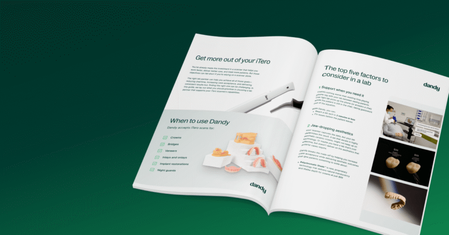 Five Lab Non-Negotiables for iTero Users