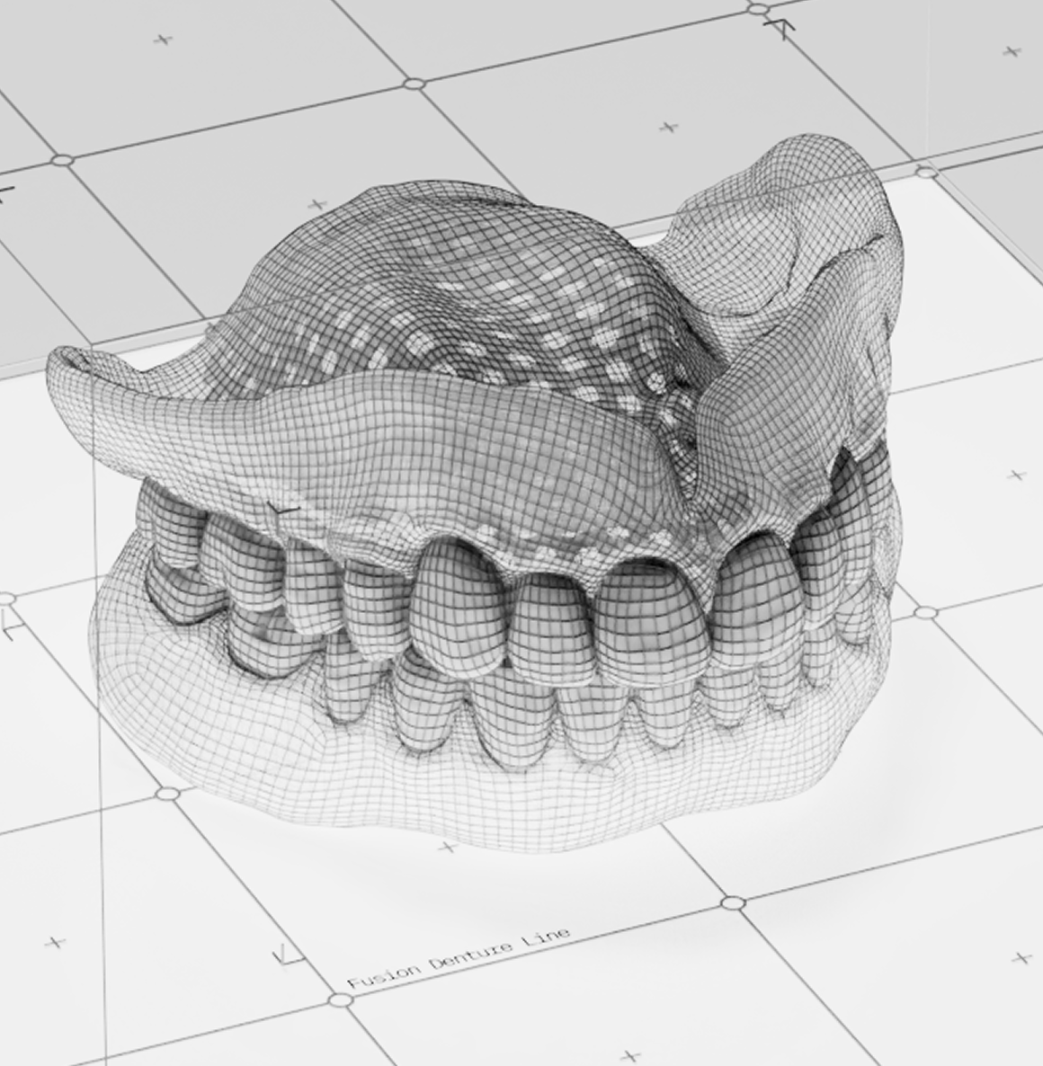 fusion-dentures-page-media-image-switchback-2